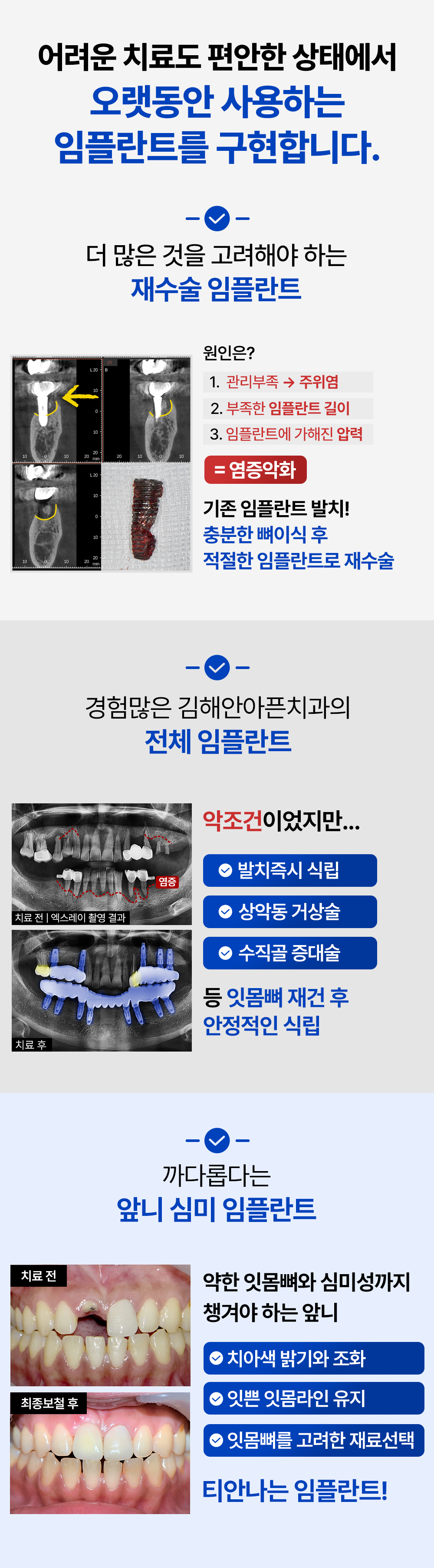 오랫동안 사용하는 임플란트를 구현합니다.